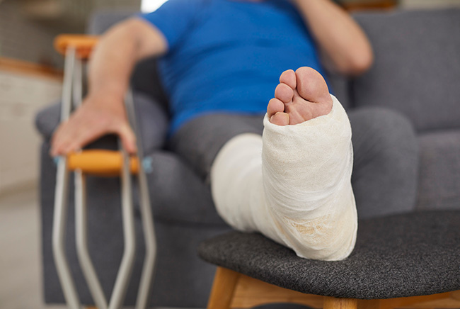 A person wearing a blue shirt sits on a couch with their leg in a white cast elevated on a chair. Their hand rests on a pair of crutches beside them.